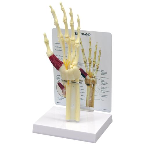 Modelo de Síndrome do Túnel do Carpo da Mão/Pulso, 1019519, Modelos de esqueletos do braço e mão