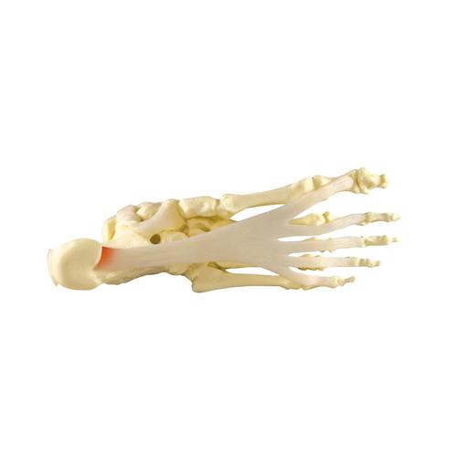 Modelo de Pé/Tornozelo - Fascite Plantar, 1019522, Modelos de esqueletos da perna e pé