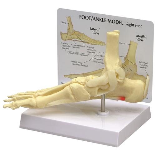 Modelo de Pé/Tornozelo - Fascite Plantar, 1019522, Modelos de esqueletos da perna e pé