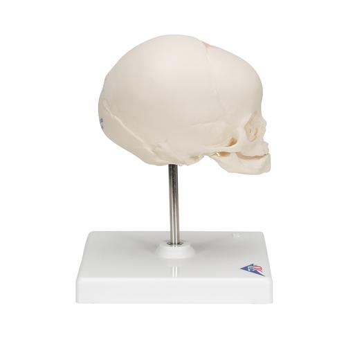 Crânio de feto, montado sobre um suporte, 1000058 [A26], Modelo de crânio