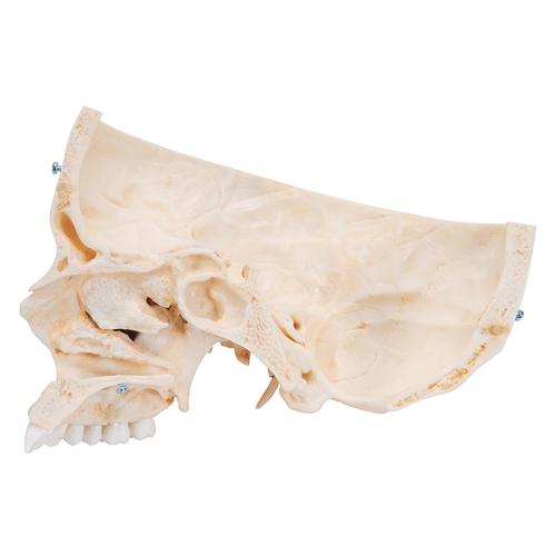 BONElike Crânio – estruturas ósseas do crânio, 6 peças, 1000062 [A281], Modelo de crânio
