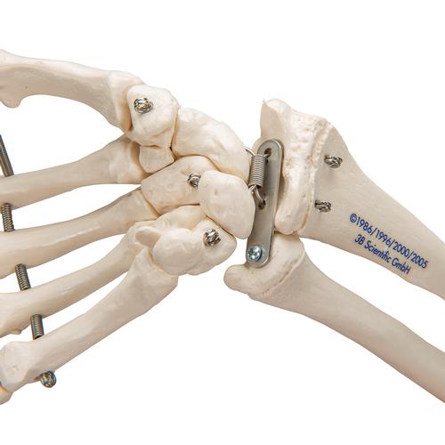 Esqueleto da Mão, com parte da ulna e do rádio, montado em arame, 1019370 [A41], Modelos de esqueletos do braço e mão