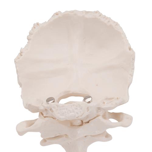 Atlas e áxis com lâmina occipital, 1000142 [A71/5], Modelos de ossos individuais