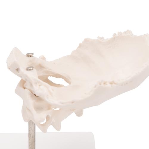 Atlas e áxis com lâmina occipital, 1000142 [A71/5], Modelos de ossos individuais
