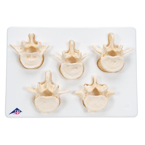 Kit com 5 vértebras lombares, 1000155 [A792], Modelos de vértebras