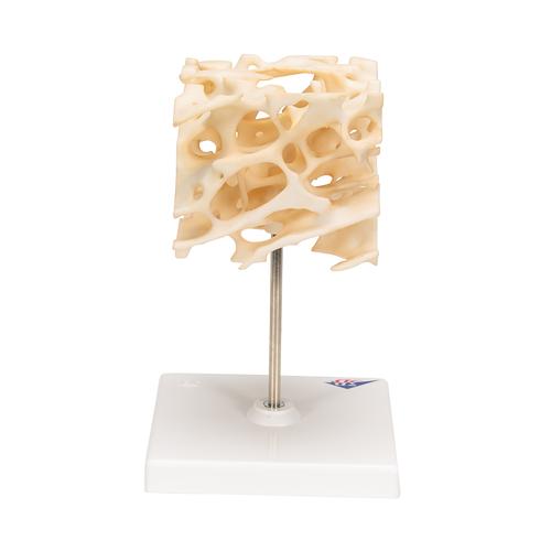 Osso esponjoso, 1009698 [A99], Modelos de ossos individuais