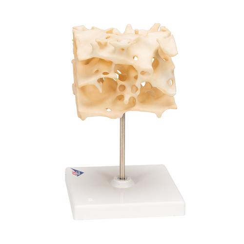 Osso esponjoso, 1009698 [A99], Modelos de ossos individuais