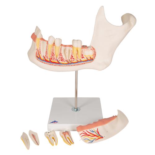 Metade inferior da mandíbula, 3 vezes o tamanho natural, 6 partes, 1000249 [D25], Modelos dentais