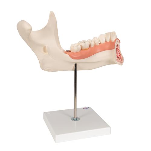 Metade inferior da mandíbula, 3 vezes o tamanho natural, 6 partes, 1000249 [D25], Modelos dentais