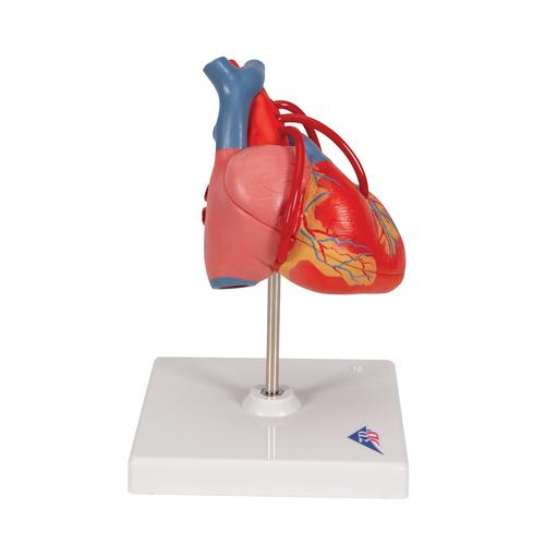 Coração clássico com pontagem coronária, 2 partes, 1017837 [G05], Modelo de coração e circulação