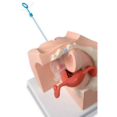 Simulador ginecológico para esclarecimento do paciente, 1013705 [P53], Educação: Saúde da Mulher