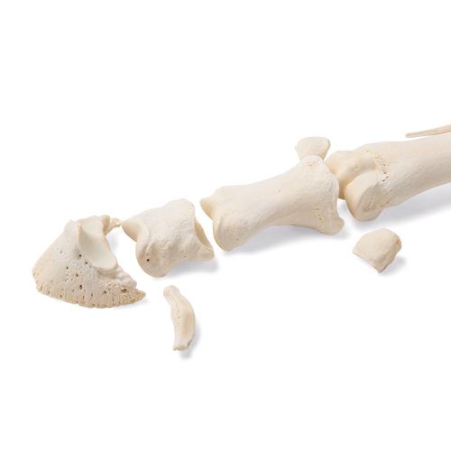 Cavalo metatarso, 1021068 [T30069], Osteologia