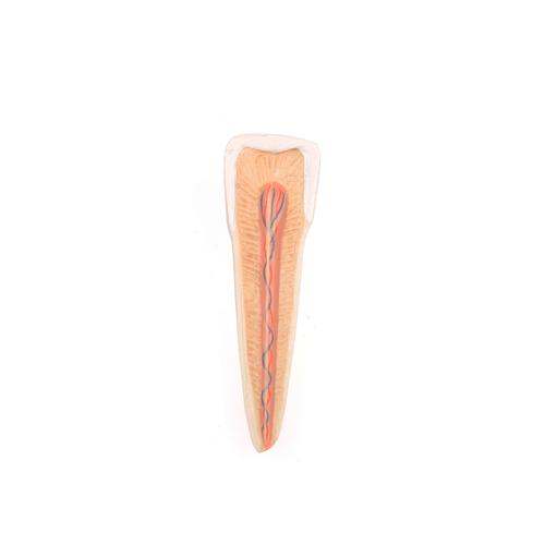 Metade inferior de mandíbula avançada com adição de 8 dentes cariados, 19 partes, 1001250 [VE290], Modelos dentais