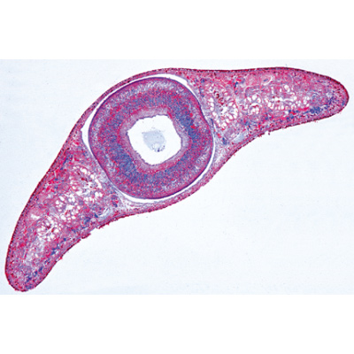 Vermes (Helmintos) - Português, 1003857 [W13003P], Preparados para microscopia LIEDER