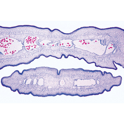 Vermes (Helmintos) - Português, 1003857 [W13003P], Preparados para microscopia LIEDER