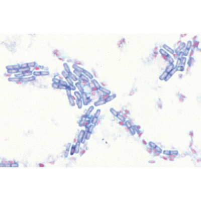 Bactérias Jogo Básico - Português, 1003886 [W13011P], Preparados para microscopia LIEDER