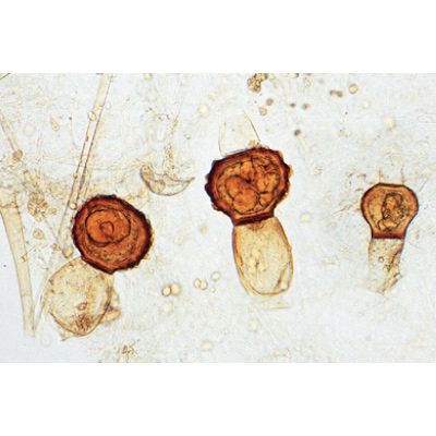 Fungos e Liquens - Português, 1003894 [W13013P], Preparados para microscopia LIEDER