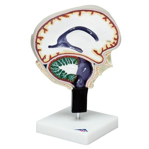 Circulação do líquido cefalorraquidiano, 1005114 [W19027], Modelo de cérebro