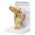 Modelo de Mão com Artrite Reumatoide, 1019521, Modelos de esqueletos do braço e mão (Small)