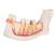 Metade inferior da mandíbula, 3 vezes o tamanho natural, 6 partes, 1000249 [D25], Modelos dentais (Small)