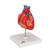 Coração clássico com pontagem coronária, 2 partes, 1017837 [G05], Modelo de coração e circulação (Small)