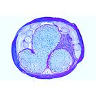 Embriologia de Ascaris megalocephala, 1013482 [W13087], Divisão celular