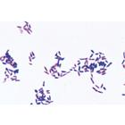 Bactérias Patogênicas - Português, 1004148 [W13324P], Português