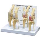 Modelo de Joelho Canino com Osteoartrose, Normal + 3 Condições, 1019577 [W33373], Osteologia